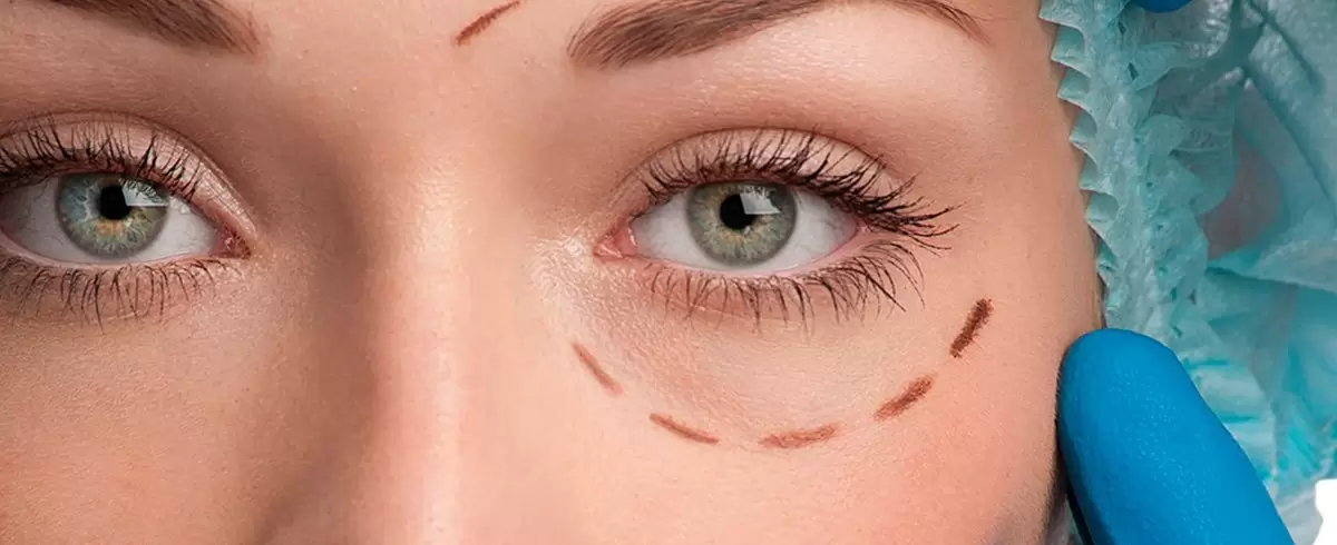 Plástica Ocular e Estética